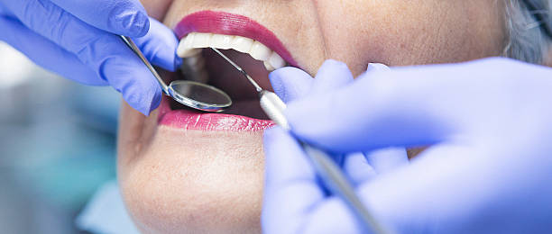 Best Emergency Denture Repair in Bristol, VA